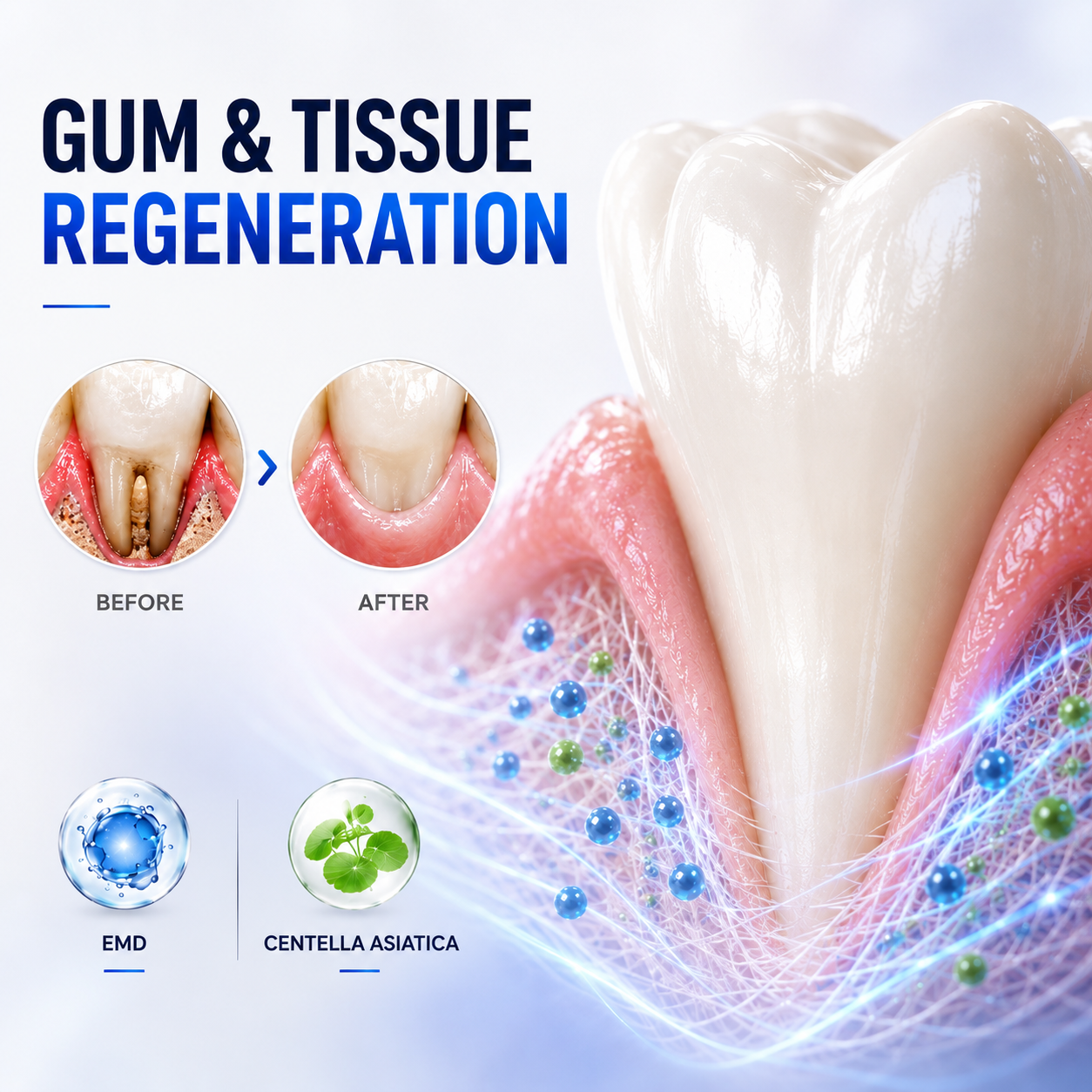 Periodontal Repair Gel