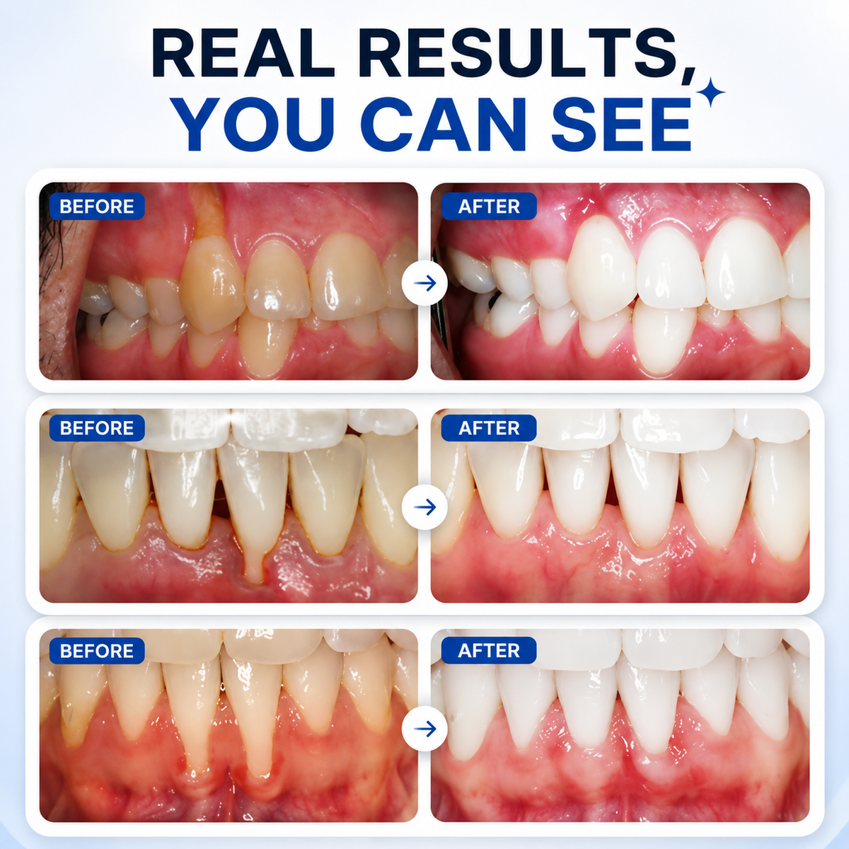 Periodontal Repair Gel