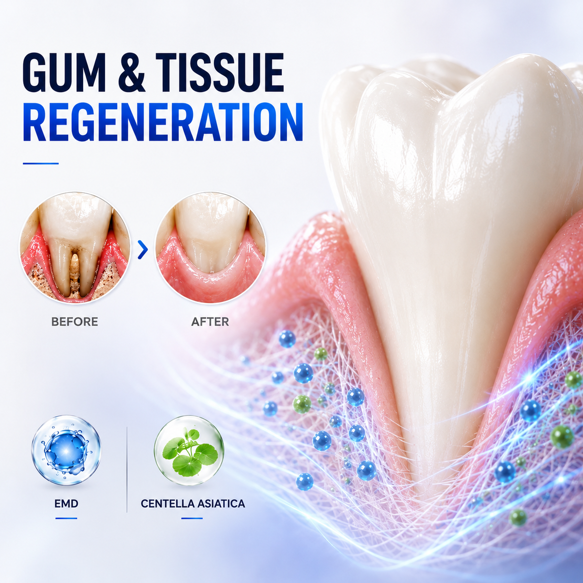 Periodontal Repair Gel